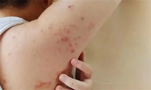 细节说明