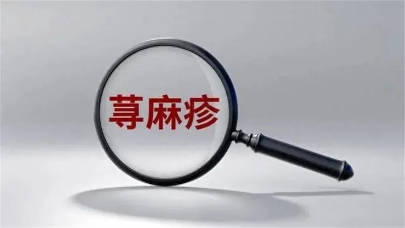 详细展示