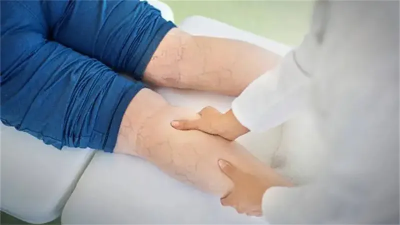 细节介绍